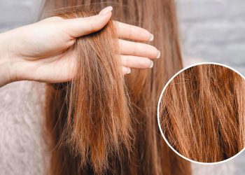 Nguyên nhân khiến tóc bạn ngày càng xơ xác