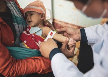 Việt Nam cần khẩn trương giải quyết vấn đề Suy dinh dưỡng cấp tính nặng ở trẻ em