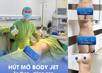 Dr Duy Anh – Hút mỡ công nghệ Body Jet cho body chuẩn Sline